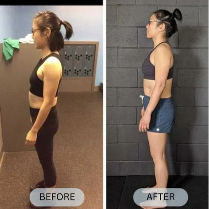Posturian™ Anti-Humpback Back Brace Posture Corrector