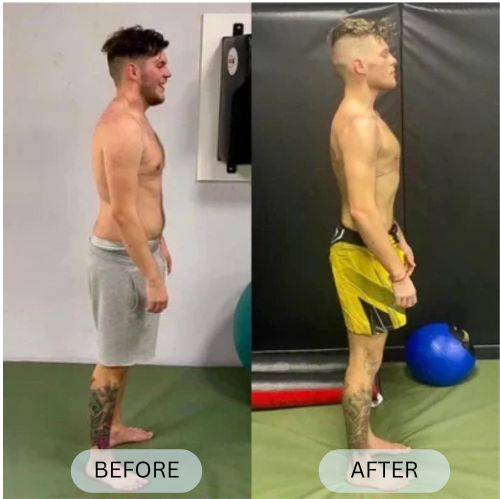 Posturian™ Anti-Humpback Back Brace Posture Corrector