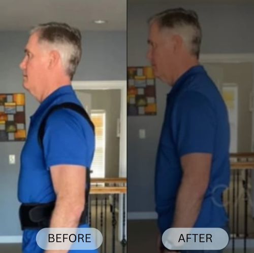 Posturian™ Anti-Humpback Back Brace Posture Corrector