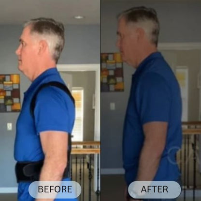 Posturian™ Anti-Humpback Back Brace Posture Corrector